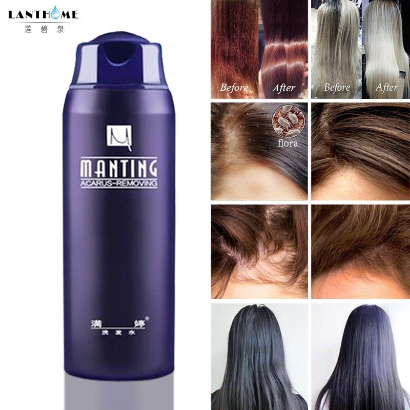 ManTing Professional Shampoo Divide Mite Anti-Itching Anti Dandruff Suitable No Silicone Oil Oil Control for All Hair Types