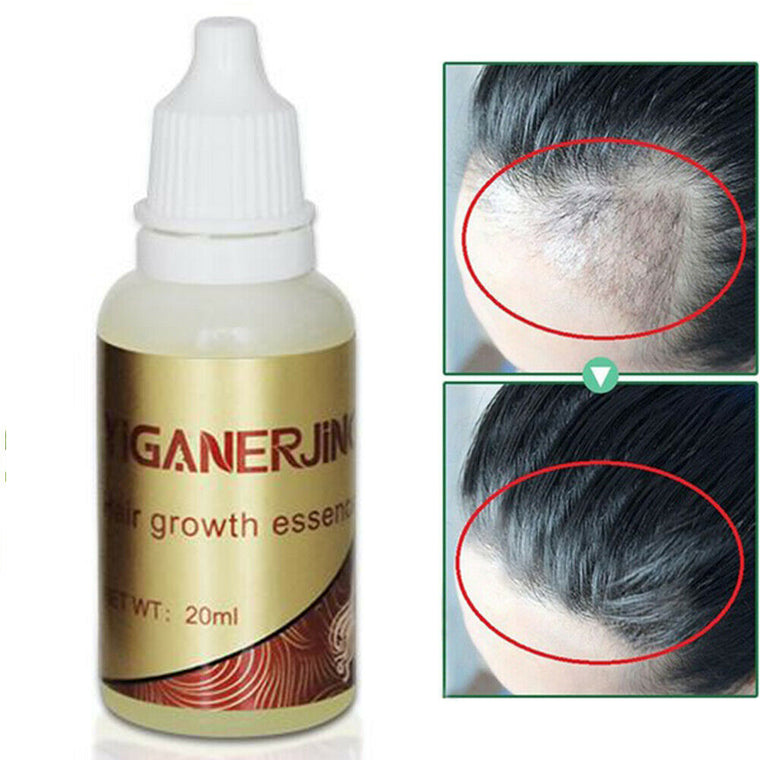 1pcs Anti Hair Loss Oil Products Organic Fast Hair Growth Essence Liquid Hair Loss Treatment Faster  Hair Growth TSLM2